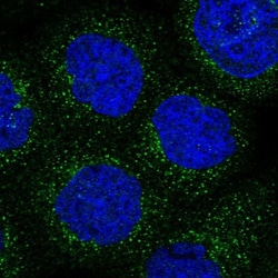 ARHGAP30 Antibody, Novus Biologicals 25 &mu;L; Unlabeled:Antibodies, Polyclonal
